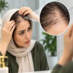علت ریزش موی جلو سر چیست؟